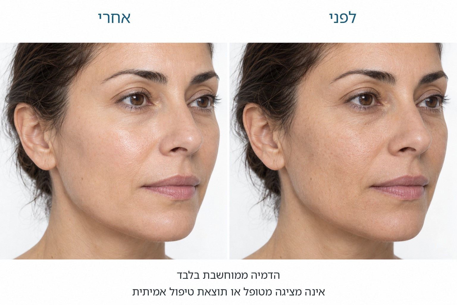הדמיה ממוחשבת של איכות העור, לפני מימין ואחרי משמאל